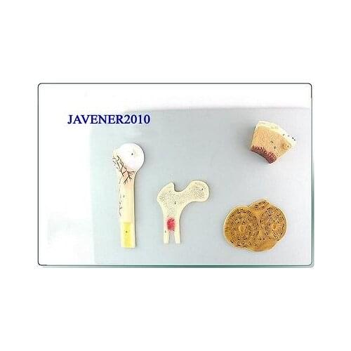 4-Part Human Anatomical Skeleton Medical Model Haversiansystem