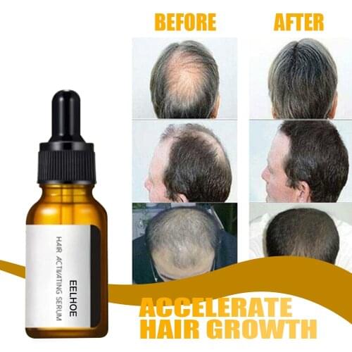 High Quality Hair Activating Serums Hair Care Essence Nourishing Moisturizing Repairing Hairs