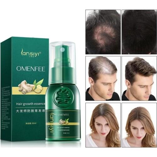 7 Days Effective Germinal Repair Growing Treatment Liquid Plant nursing refreshing nourishing New Ginger Hair Growth Spray