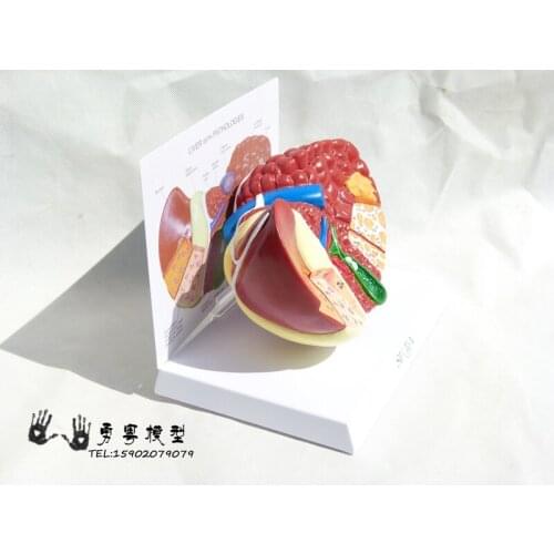 Human pathology liver model Visceral enlarge anatomical model free shipping