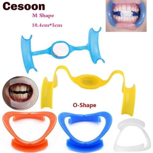 Cesoon 2Pcs Dental M-Shape Mouth Opener With Mirror Orthodontic Teeth Cheek Lip Retractor Blue/Yellow 10.4cm*5cm