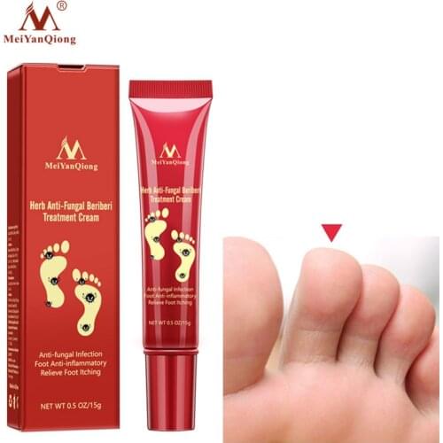 Herbal Effective Foot Treatment Anti Fungal Infection Onychomycosis Paronychia Toe Fungus Treatment Feet Repair Cream Foot Care