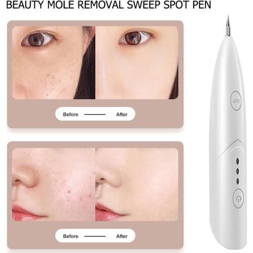 Mini Laser Pen Mole USB Freckle Removal Dark Spot Remover Skin Point Pen Electric Mini Mole Removal Machine Face Skin Care