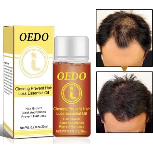 20ML Ginseng Hair Growth Essence Preventing Hair Loss Liquid Damage Hair Repair Treatment Dense Fast Restoration Hair Growth