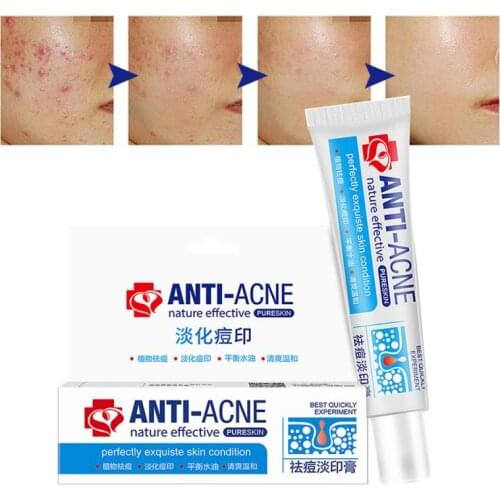 Traditional Chinese medicine for acne treatment, remove acne marks, shrink pores, whiten, moisturizing face cream