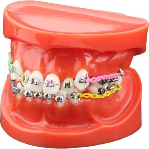Dental Orthodontic Treatment Model Demo Metal Bracket Arch Wire Ties Chains Red