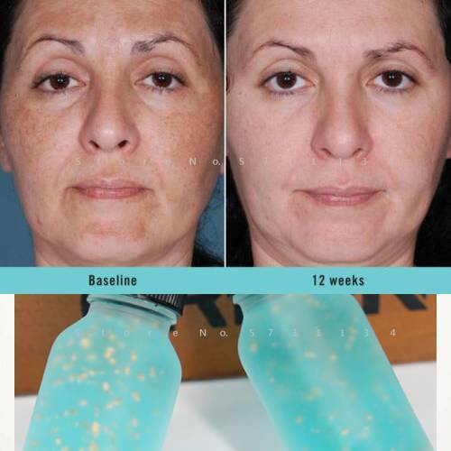 Dark Skin Whitening Lightening Ultra Brightening Serum Dark Spot Bleaching Cream