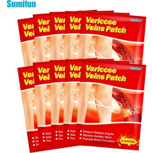 Sumifun 42/84pcs Varicose Veins Plaster Chinese Medical Patch Vasculitis Phlebitis Spider Leg Skin Care Angiitis Removal Patch
