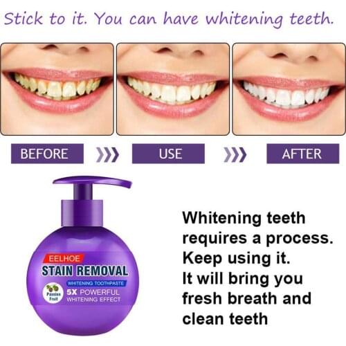 Remove Stains Passion Fruit Baking Soda Toothpaste Decay Tooth Whitening Intensive Tool Clean Instant U7S9