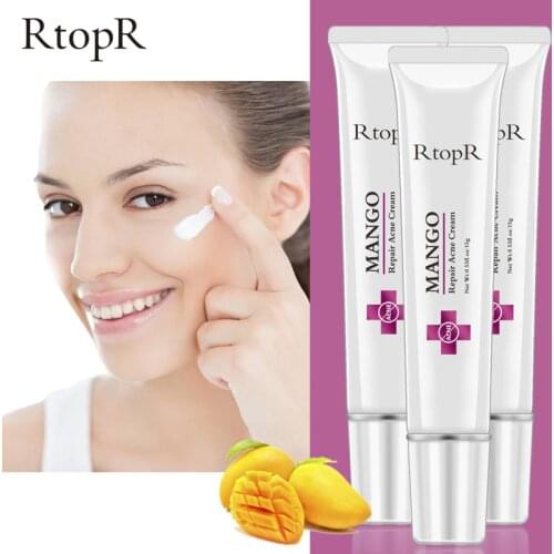 RtopR Acne Cream Mango Anti-acne oil control Face cream For Women And Man Repair Acne And Blackhead Spots Pore Shrinking Cream