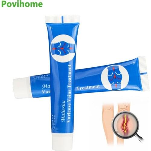 25g Veins Varicose Nodules Ointment Spider Leg Varicose Veins Treatment Cream Relief Vasculitis Swelling Cream Skin Care