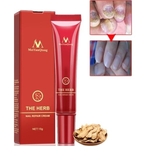 1pc Chinese herbal Nail Foot Protector Skin Care Cream 15g Nail Fungus Treatment the Herb Nail Repair Cream