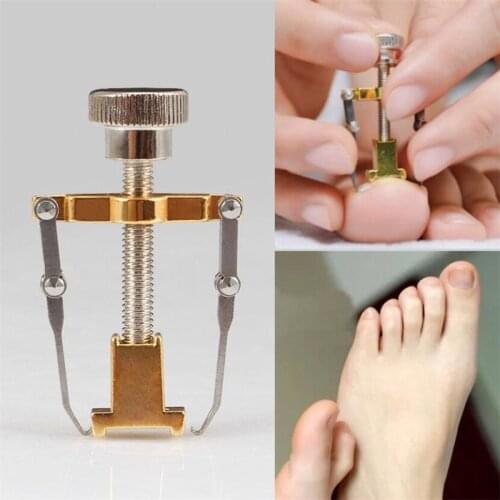 Ingrown Toenail Toe Fixer Recover Correction Device Pedicure Foot Nail Care Tool Straightening Clip Brace corrector Wire Fixer