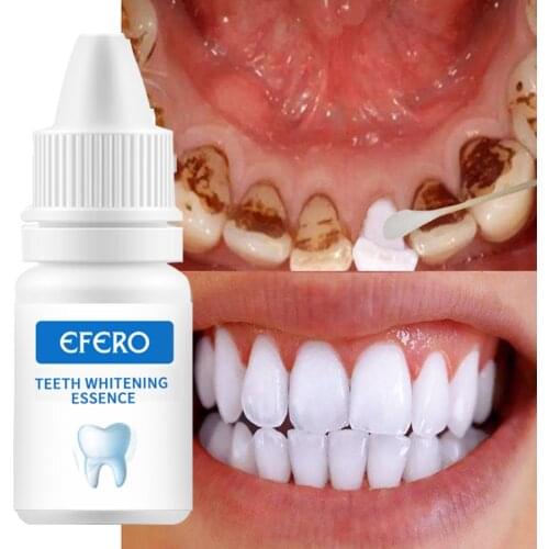 EFERO Teeth Whitening Essence Powder Clean Oral Hygiene Whiten Teeth Remove Plaque Stains Fresh Breath Oral Hygiene Dental Tools