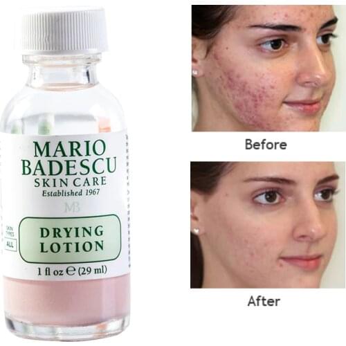 An effective Acne Treatment ORIGINAL Mario Badescu Drying Lotion 29ml Anti Acne Serum Pimple Blemish Removal
