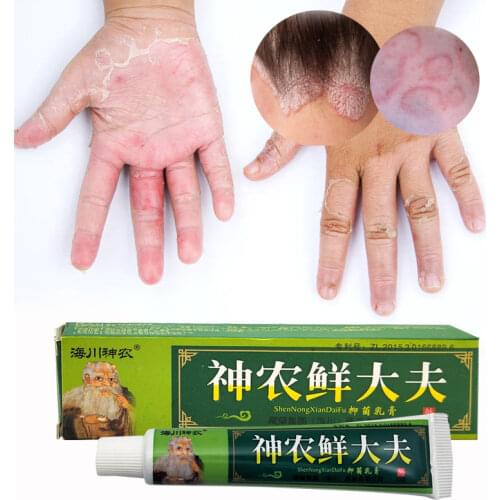 15g Natural Chinese Medicine Herbal Anti Bacteria Cream Psoriasis Eczema Ointment Treatment High Quality Herbal Cream