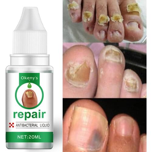 Okeny's Sets For Children's Nails