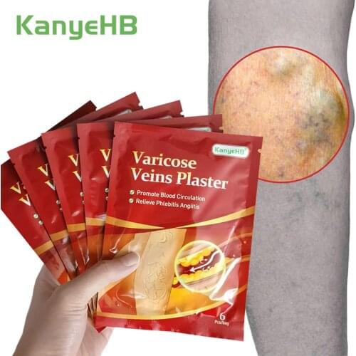 18pcs/3bags Varicose Veins Treatment Plaster Varicosity Angiitis Patch Relief Veins Pain Phlebitis Medical Health Care Plaster