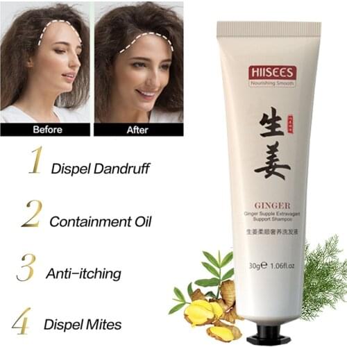 Ginger Hair Growth Shampoo Anti Hair Loss Conditioner Hair Regrowth Treatment Make Hair Stronger Thicker Care Products