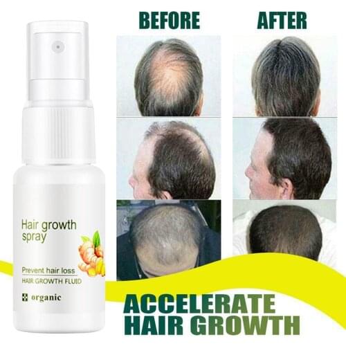 20ml Ginger Herbal Health Strong Strength Growth Hair Liquid Treatment Spray