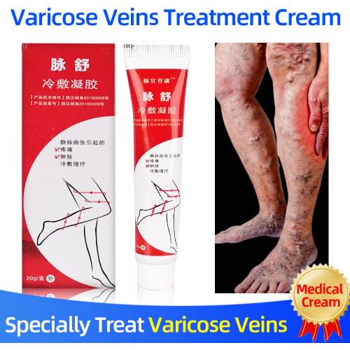 Varicose Vein Cold Compress Gel Phlebitis/Vasculitis Treatment Ointment Varicosity Angiitis Pain/Swelling Relief Body Care Cream