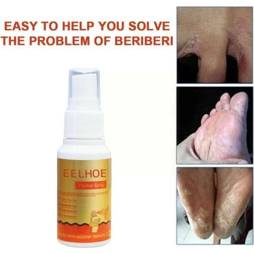 30ml Anti-fungal Foot Spray Foot Care Spray For Beriberi, Itching, Erosion Care Peeling Foot Foot And Nemesis Cream Athlete Y6G5