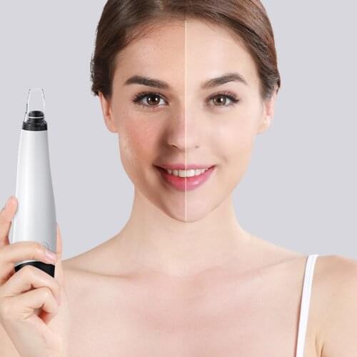 Facial Electric Acne Cleaner Blackhead Remover Acne Cleaner Blackhead Black Point Vacuum Cleaner Tool Pore Cleaner Machine