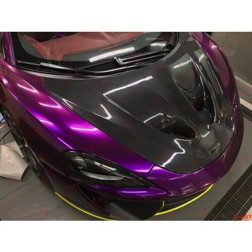 Z-ART for Mclaren 540 P1 carbon fiber front lid for Mclaren 570 carbon fiber front trunk lid for Mclaren 570S P1 front hood