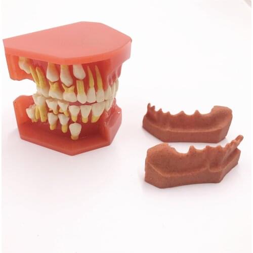 Dental Tooth Teeth Anatomical Anatomy Model Children Dental Model Baby teeth mold