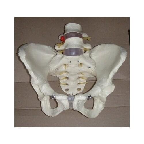 1:1 Female pelvis model Pathological changes Human Skeleton model Medical Teaching free shipping