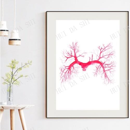 Pulmonary Embolism Angiography, CT Angio, Radiology Art Print, Pulmonary Medicine Art, Cardiovascular Surgery Art