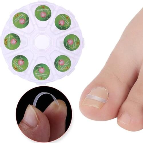 100pcs Ingrown Toenail Correction Tool Ingrown Toe Nail Treatment Elastic Patch Sticker Straightening Clip Brace Pedicure Tool