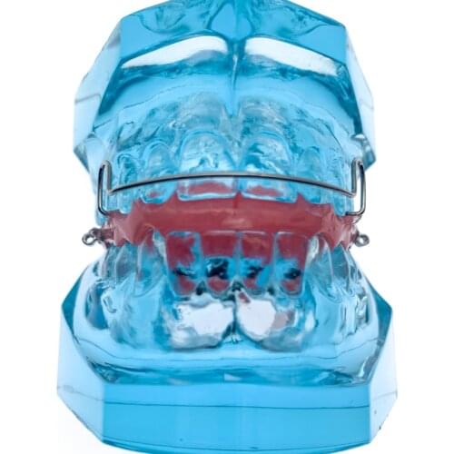 Dental Functional Orthopedic Bionator Removable Model 3006 Dental Teach Study Teeth Model