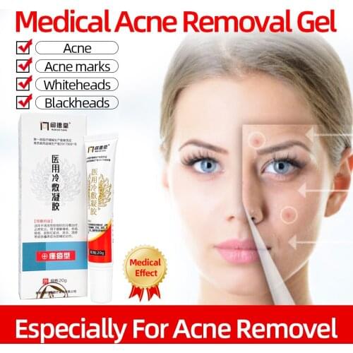 20gMedical Acne Cream Anti Acne Gel Improve Acne Marks ScarsTreatment Removal Cream Face Skin Care