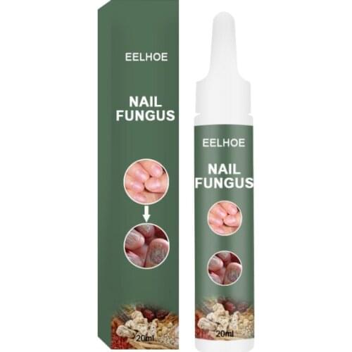 More Complete Ginger to Promote Manicure Nails Repair Liquid Kill Deep Fungal Mutants Gel Fingernail Care Feet & Hand Care TSLM1