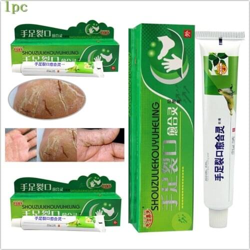 Hand Foot Crack Repair Cream Heel Chapped Peeling Foot and Hand Repair Anti Dry Crack Skin Care Chinese Ointment HOT SALE