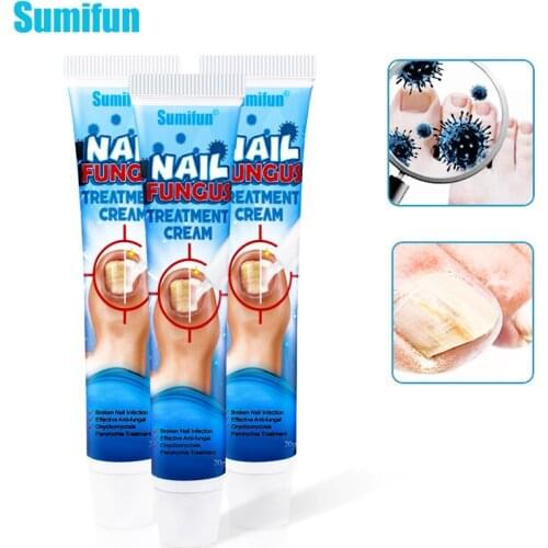 3pcs Sumifun Nail Treatment Ointment Anti Infection Remove Onychomycosis Fungus Paronychia Promote Nail Growth Nail Care K10010
