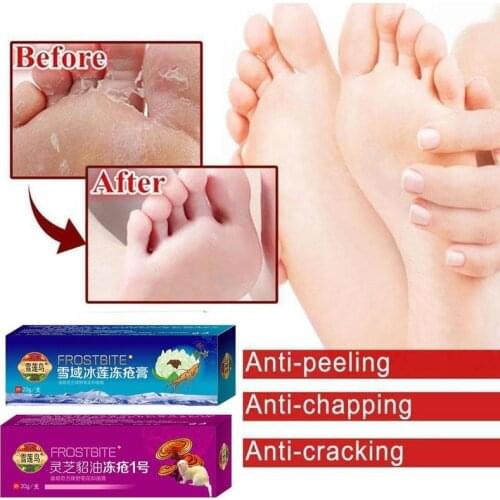 20g Ganoderma Lucidum Dry Cracking Cream Heel Chapped Peeling Repair Ointment Cream Hand Footanti Dry Chapped Cream