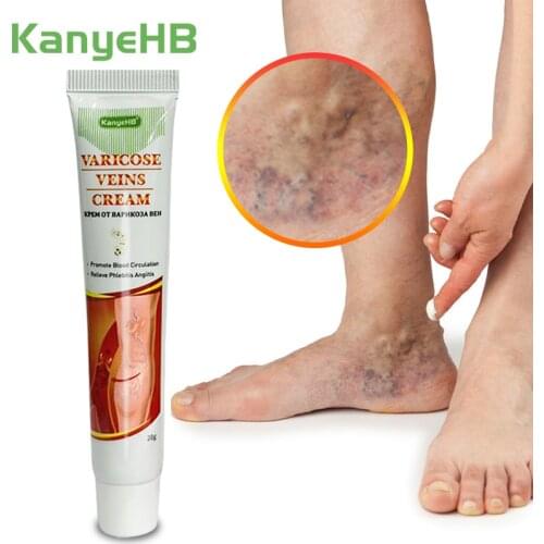 1pcs Varicose Veins Treatment Ointment Varicosity Angiitis Removal Vasculitis Phlebitis Spider Leg Pain Relieving Herbal Plaster