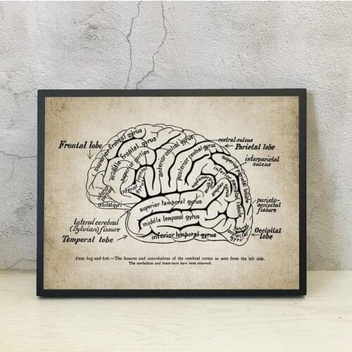 Nordic Print Human Brain Anatomy Illustration Vintage Poster Art Canvas Painting Doctor Office Wall Artwork Decor Medicine Gifts