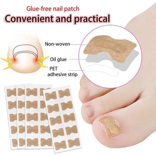 4-60Pcs Non-Glue Toenail Patch Ingrown Toenail Correction Pedicure Tool Toe Inlay Nail Corrector Nail Patch Correction Stickers