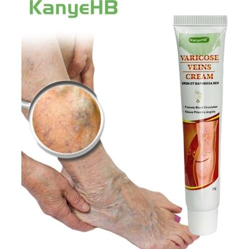 Varicose Veins Treatment Cream Vasculitis Phlebitis Spider Ointment Varicosity Angiitis Leg Pain Removal Herbal Medical Plaster