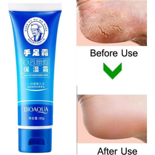 80g Anti-Drying Crack Foot Cream Heel Cracked Repair Cream Removal Dead Skin Hand Feet Care For Family