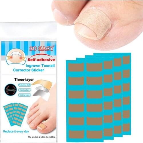 36pcs Ingrown Toenail Patch Corrector Pedicure Tool Toenail Correction Patch Female Men Foot Care Ingrown Nail Correction Tool
