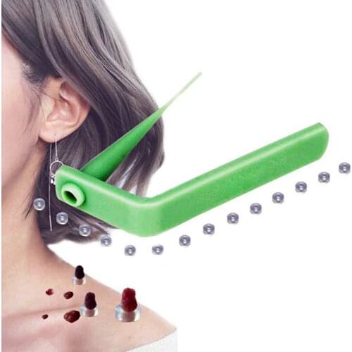 Face Care Skin Tag Removal Tool Skin Tag Remover Skin Mole Wart Remover Micro Band Skin Tag Removal Tool With Cleansing Pads