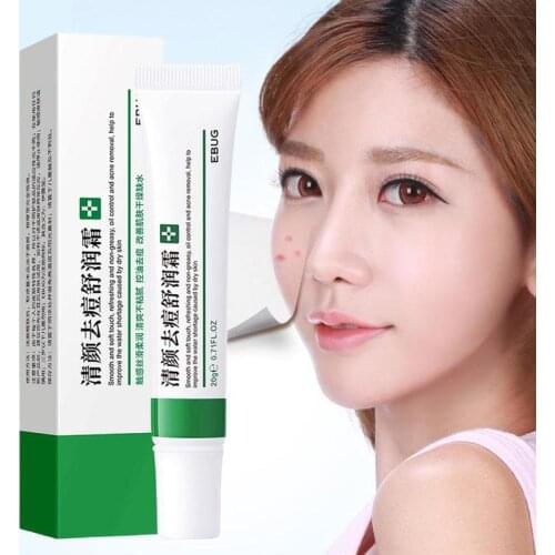 Acne Removal Cream Fade Acne Control Shrink Pores Whitening Moisturizing Acne Cream Skin Care Acne Treatment Face Cream