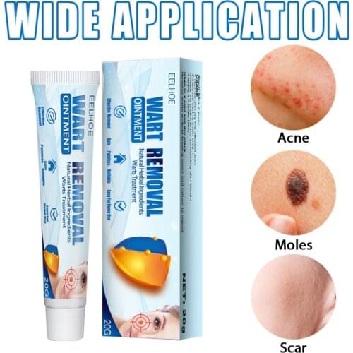 EELHOE Warts Remover Cream Skin Tag Removal Antibacterial Ointment Warts Remover Mole Skin Dark Spot Treatments Herbal Creams
