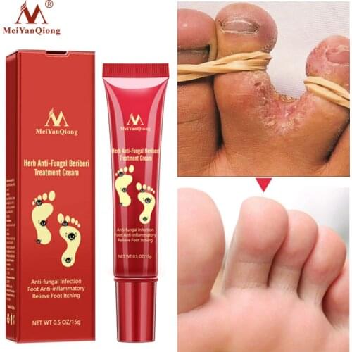 VOVA Foot Gels
