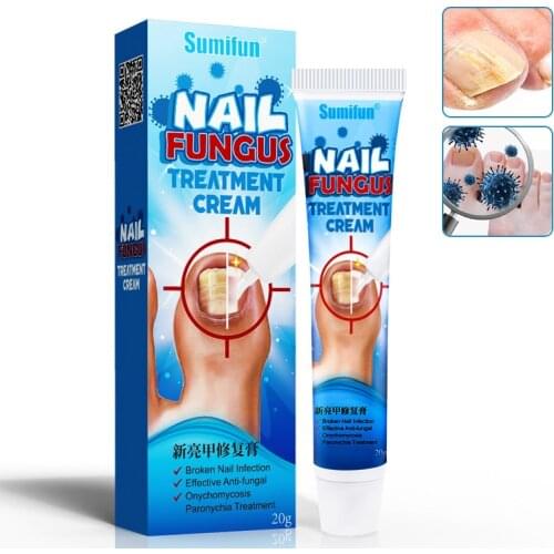 Free shipping 20g*2 nail cream onychomycosis soft nail stripping ointment