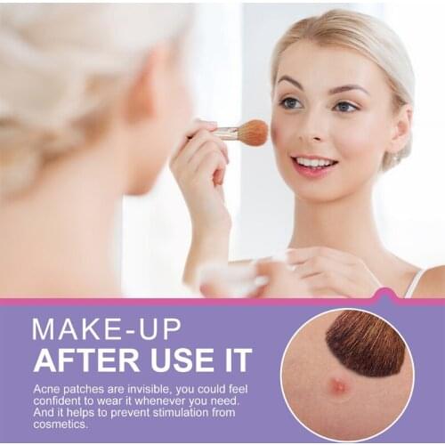 Acne Pimple Patch 3 Sizes Hydrocolloid Zit Stickers for Spot Treatment Cover